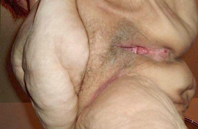 Check This Out Anal Pussy Boobs Fat Photo And Plump Elder Hairy Spread Tumblr